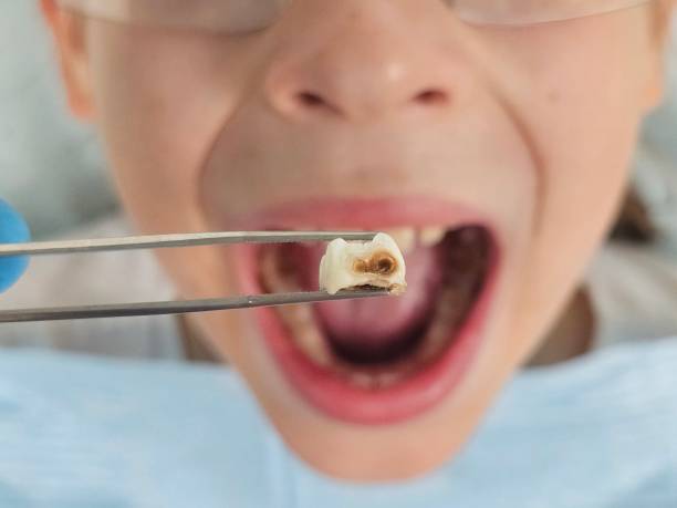 Best Pediatric Emergency Dentist in Groves, TX