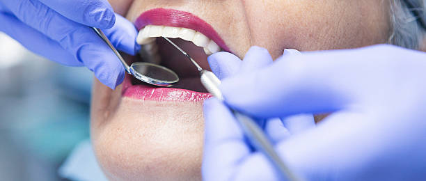 Best Broken or Cracked Tooth Emergency Dentist in Groves, TX