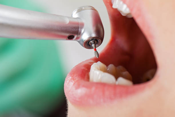 Best Emergency Cosmetic Dentistry in Groves, TX